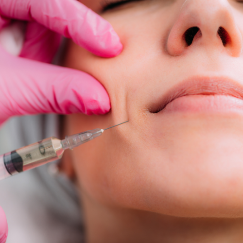 Dermal fillers