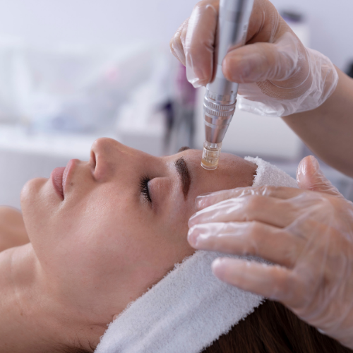 Microneedling