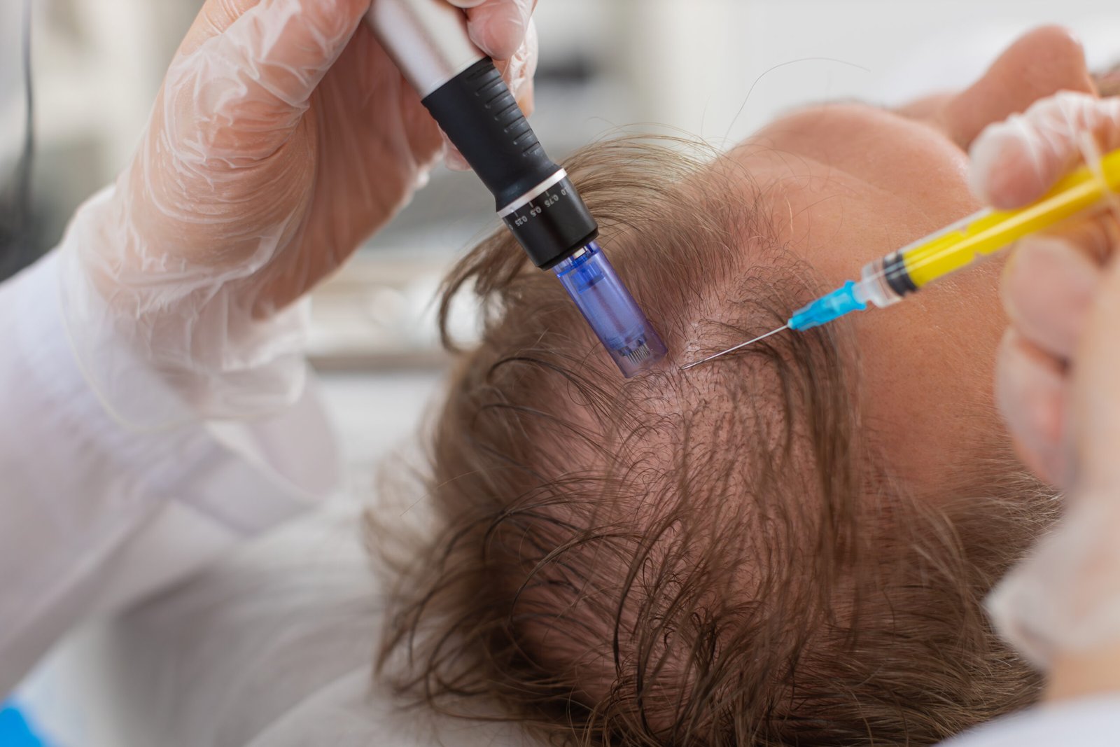Biotin injections Sutton-in-Ashfield