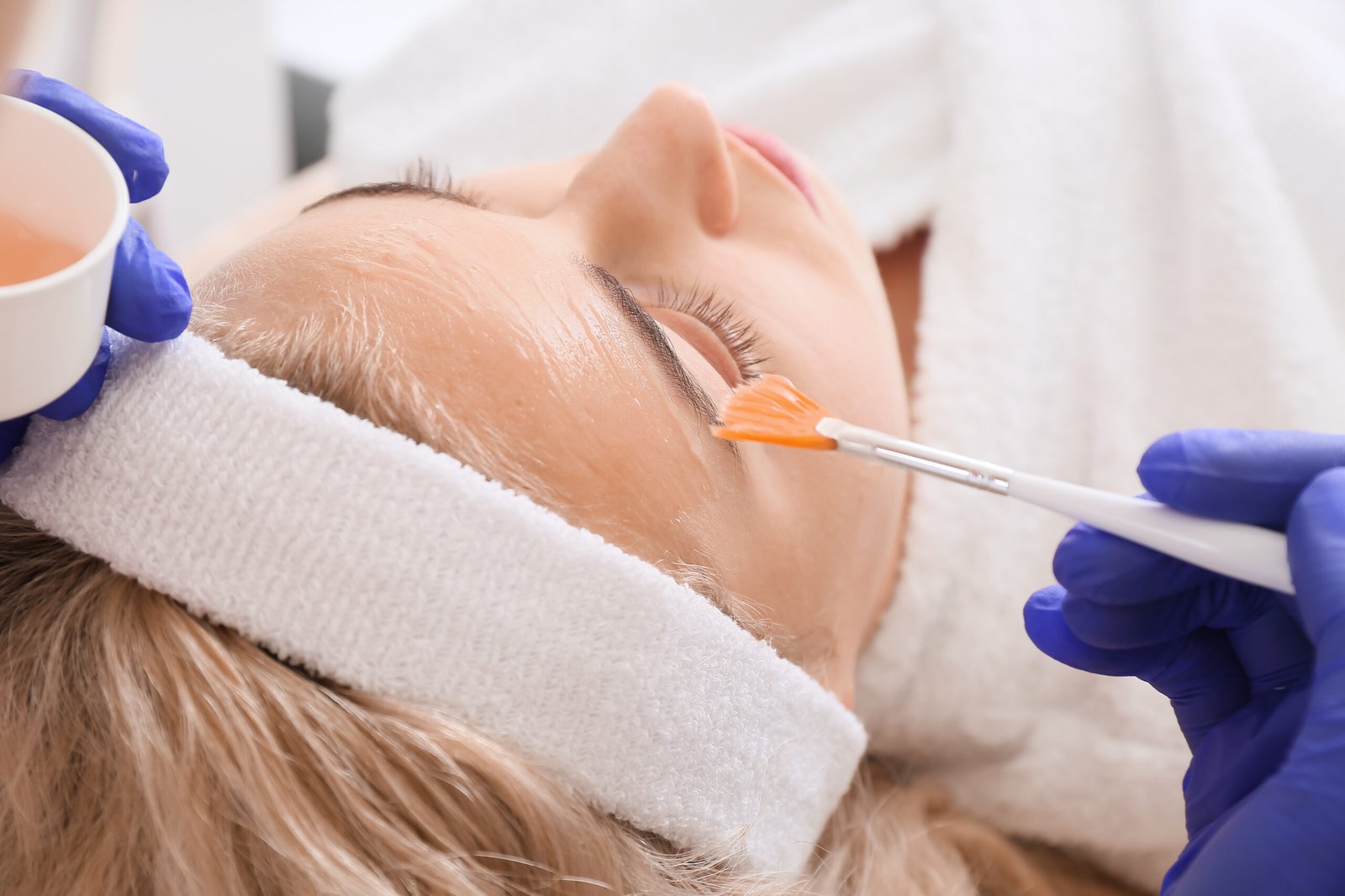 Chemical peels skin rejuvenation treatment